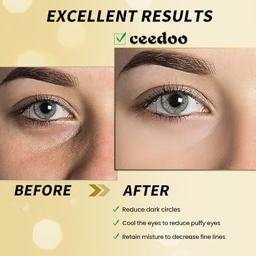 Ceedoo Under Eye Patches - 24 Pairs Gold Under Eye Mask for Puffy Eyes, Dark Circles, Eye Bags, Wrinkles, Collagen Hyaluronic Acid Eye Gel Pads with Rejuvenating Treatment, Refresh Your Skin