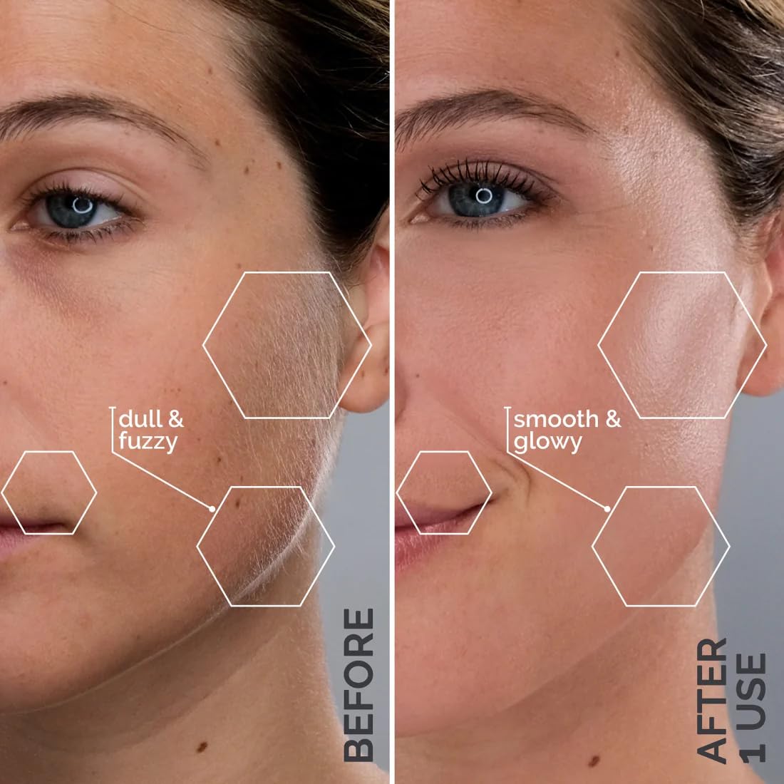 Michael Todd Beauty - Sonicsmooth Pro+ Dermaplaning Blade Refills - 8 Dermaplaning Blades- 2 Month Supply - Device Not Included