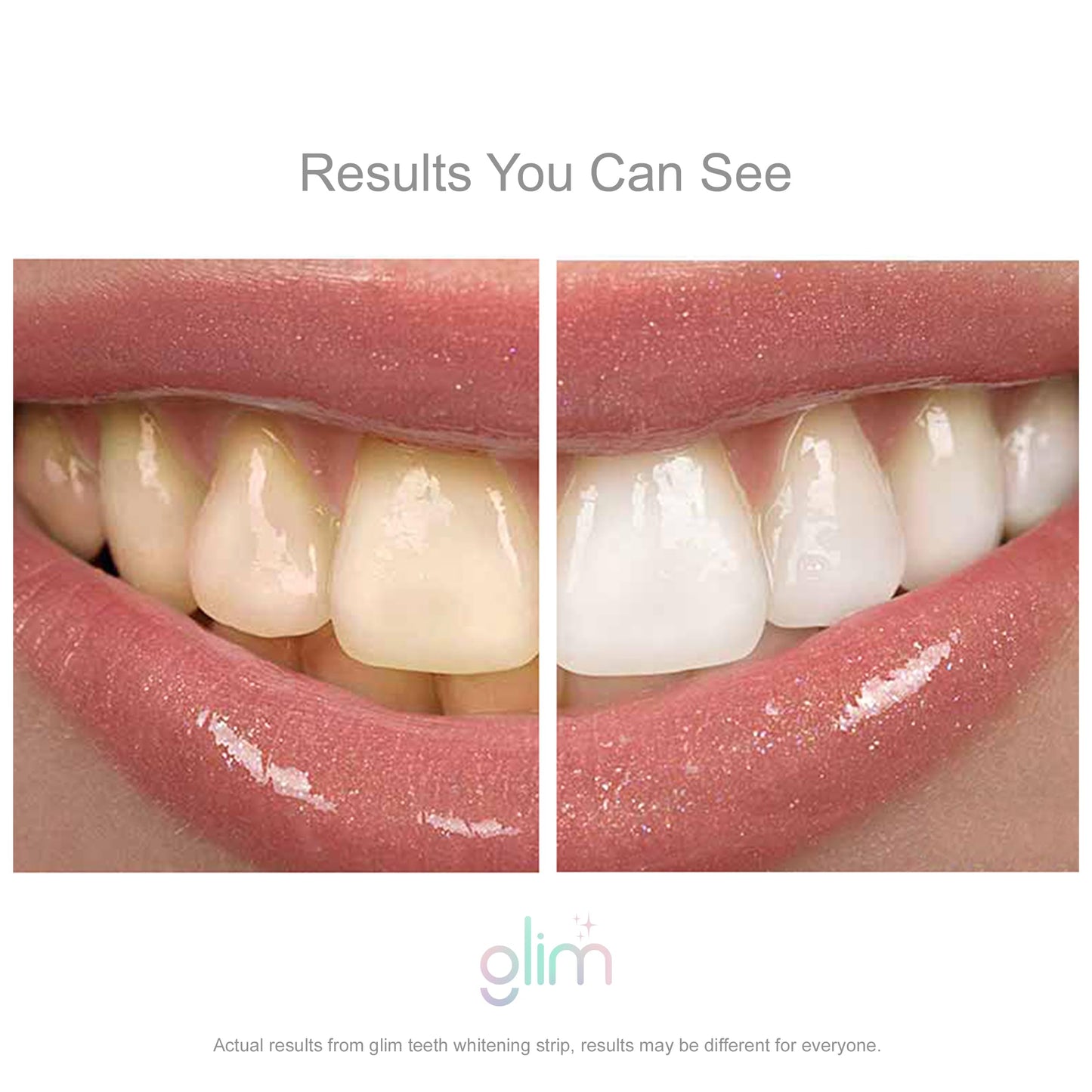 Professional Teeth Whitening 42 Strips (21 Pack), Hydrogen-Free, Non-Toxic, Dentist Recommended, Sensitivity Free - Vegan & Cruelty Free - (Mint)