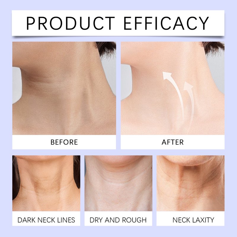 Multi Action Neck Firming Cream - Moisturizing Anti-Aging Skin Care 1.76oz