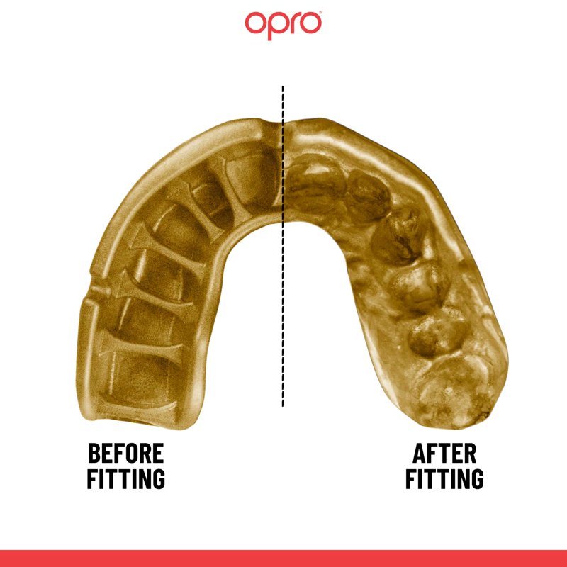 Self-Fit Gold Level Mouth Guard for Boxing, MMA & Football - Adult