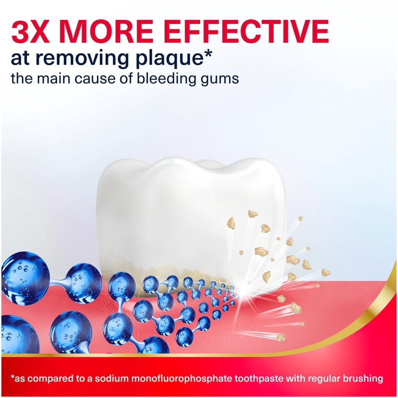 Whitening Toothpaste for Bleeding Gums - Parodontax Active Gum Repair Mint 3.4 oz