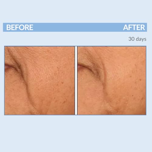 Serious Skincare A Force XR Serum Retinol Concentrate - Vitamin A - Time Released ? Lightweight Anti-Aging & Anti-Wrinkle Facial Treatment ? Green Tea Leaf Extract - 2 oz.