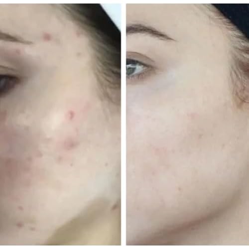 HigherDOSE Glow Serum - Facial Serum Formulated to Plump, Hydrate, and Stimulate Radiant Skin - Help Reduce Fine Lines and Wrinkles - 1 oz