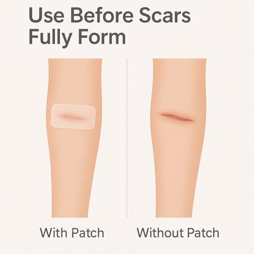 Clear Scar Sheets ? 10 Pieces ? Skin Patches for Face and Body ? Use Before Scars Fully Form ? Prevent and Reduce Scars from Acne, Scalds, Burns, Cuts, Abrasions ? Thin, Flexible, Waterproof, Gentle