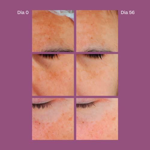 Sensilis D-pigment Serum Atx B3 30ml
