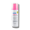 INNBEAUTY Project Acne Serum Medicated Treatment for Breakouts, Blackheads & Oil Control, 1 OZ (30ml)