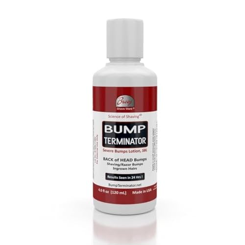 BUMP TERMINATOR Severe Bumps Treatment | Razor Bumps And Ingrown Hair Treatment | Bikini Bumps | Back of Head Bumps And Ingrown Hair Treatment, 4 oz (Pack of 1)