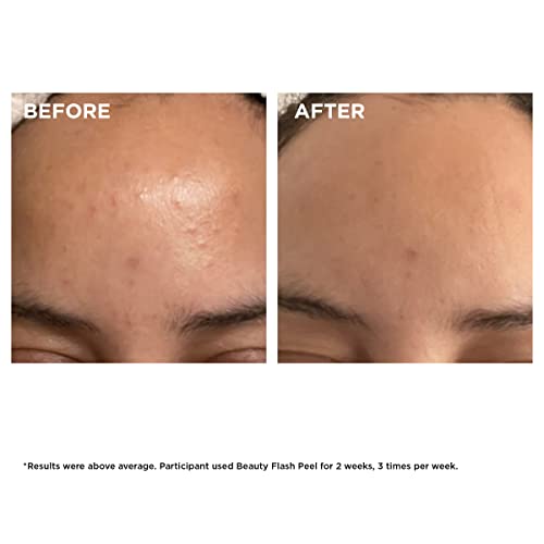 Clarins Beauty Flash Peel | 10-Minute At-Home Facial | Visibly Tightens Pores | Gently Eliminates Dead Skin Cells | Refines Skin Texture | Renews Radiance | Contains AHAs and BHAs | All Skin Types