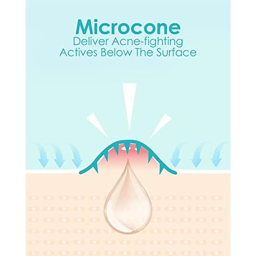 Microdart Acne Patch (36 Patches) - Hyaluronate Acid & Salicylic Acid Hydrocolloid Pimple Patch for Deep, Early and Hidden Blemishes (36 Count (Pack of 1))