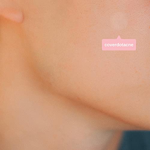 Ollie Belle Cover Dot Acne Care Skin Blemish Treatment with Hydrocolloid | Clear, Waterproof Patch (240 dots)