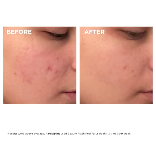 Clarins Beauty Flash Peel | 10-Minute At-Home Facial | Visibly Tightens Pores | Gently Eliminates Dead Skin Cells | Refines Skin Texture | Renews Radiance | Contains AHAs and BHAs | All Skin Types