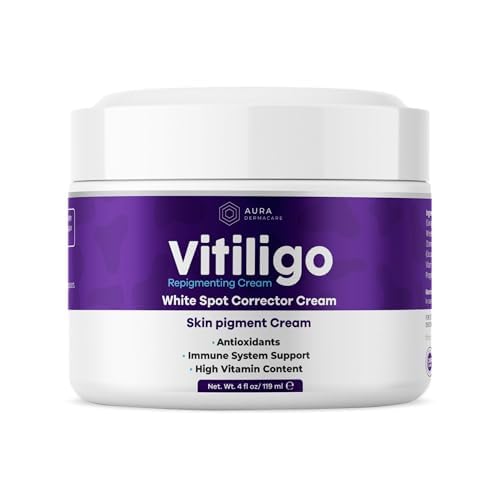Vitiligo Cream for White Spots (8oz) - Repigmenting Cream with Polypodium Leucotomos and Melanocyte Support - Promotes Even Pigmentation by Aura Dermacare
