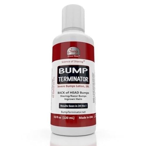 BUMP TERMINATOR Severe Bumps Treatment | Razor Bumps And Ingrown Hair Treatment | Bikini Bumps | Back of Head Bumps And Ingrown Hair Treatment, 4 oz (Pack of 1)