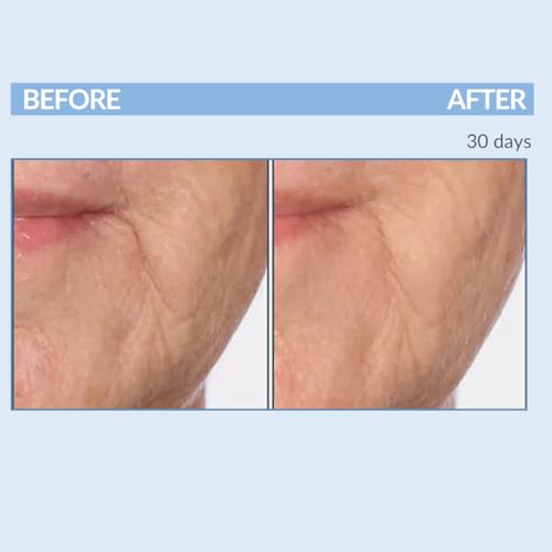Serious Skincare A Force XR Serum Retinol Concentrate - Vitamin A - Time Released ? Lightweight Anti-Aging & Anti-Wrinkle Facial Treatment ? Green Tea Leaf Extract - 2 oz.