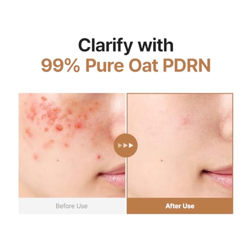 PURITO Oat PDRN Gentle Refining Toner 200 mL 6.76 fl.oz, Korean Oat Exfoliating Toner 99% Pure Oat PDRN, Hydrating & Clarifying Formula for Acne-Prone Skin, Vegan, Non-Comedogenic, Gentle Daily Use
