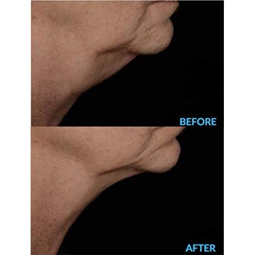 AminoGenesis N.E.C.K Control: Neck Lifting, Firming And Retracting Cream