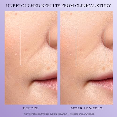 Lanc?me R?nergie H.C.F. Triple Serum - Hyaluronic Acid Serum for Visible Correction of Anti Aging Signs & Dark Spots - With Vitamin C+, Niacinamide & Ferulic Acid