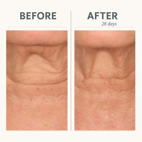Serious Skincare Reverse Lift CORREC-CHIN IN-TENSE Firming Treatment Cream, for Tightening Double Chin, Neck, Jawline, Anti-Aging Moisturizer, Firming Skin Care 1.7 oz
