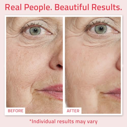 YEOUTH Retinol Serum for Face with Hyaluronic Acid & Vitamin E, Hydrating Retinol Face Serum for Women & Men, Facial Skin Care for Even Skin Tone - 1oz