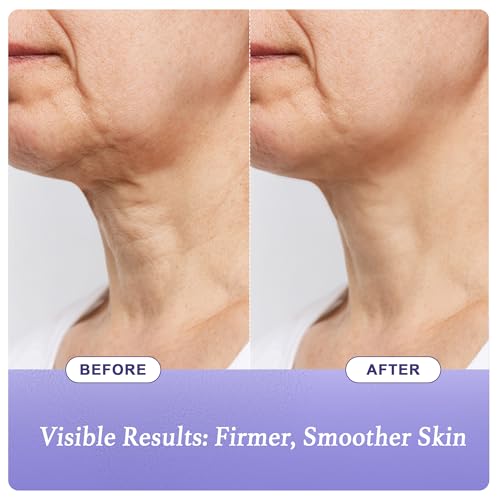 Neck Firming Cream - Anti-Aging Tightening and Lifting for Sagging Skin with Hydrating Formula, Moisturizer Face Cream for women 1.7 oz-V1