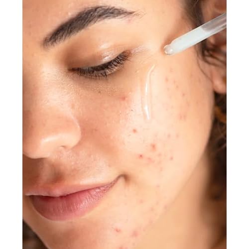 Ere Perez - White Tea Phyto Retinol Elixir | Hydrate, Plump, Soften | Bakuchiol, Resveratrol, Niacinamide | Vegan, Cruelty-Free, Clean Beauty Safe for All Skin Types (1 fl oz | 30 ml)