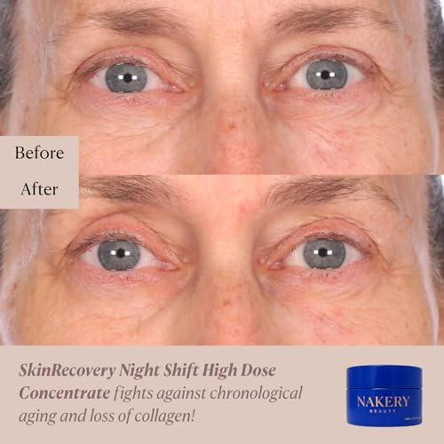 Nakery Night Shift Overnight Face Cream, Retinol Sleep Repair Cream with Methylene Blue, NAD+, and Melatonin, Anti-Aging Night Moisturizer for Fine Lines, Collagen Boost, and Cellular Renewal