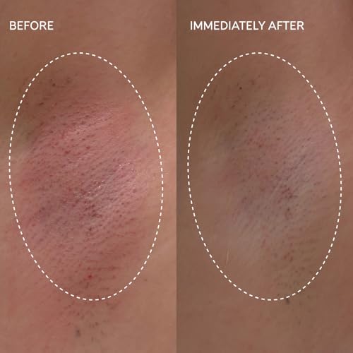 Fur Flash Repair Jelly ? Hypochlorous Acid Aftercare Gel for Post-Wax, Shave, or Laser ? Soothes Redness, Bumps, and Irritation Dermatologist-Tested, Fragrance-Free (2.0 fl oz / 60mL)