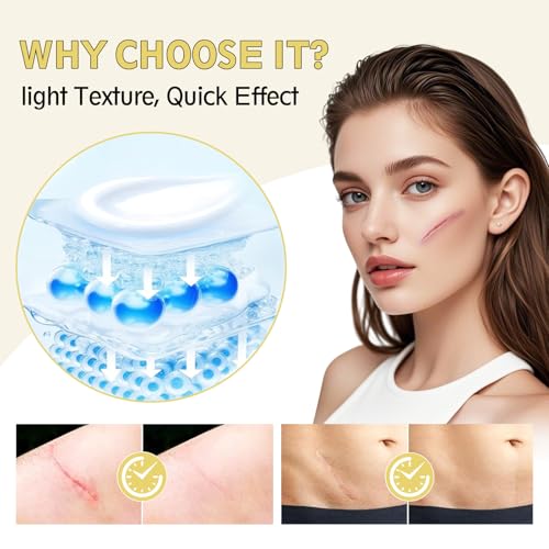 Advanced Scar Cream, Silicone Gel for Scars, Professional Scar Removal Cream for Surgical Scars, Stretch Marks, Old and New Scars, Keloids, Acne, Burns, 2 oz(60ml)
