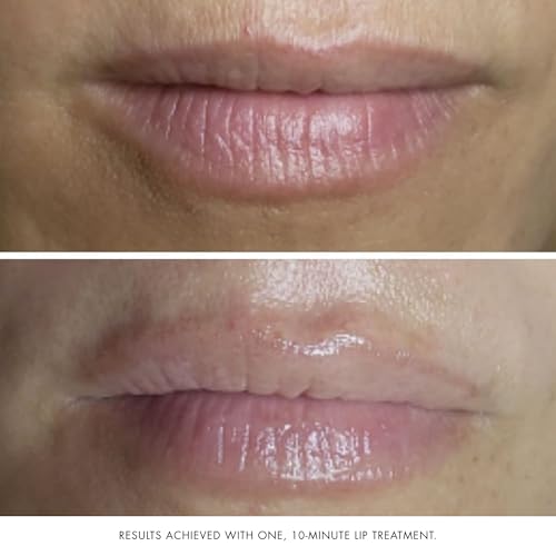 Bioelements Collagen Rehab - 1.7 fl oz - Face & Lip Mask for Aging Skin - Creates Instant Dewiness + Improves Fine Lines & Wrinkles - Vegan, Gluten Free - Never Tested on Animals