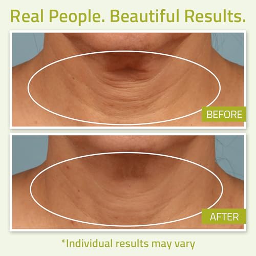 YEOUTH Neck Cream with Vitamin C, Skin Firming Moisturizer for Women and Men, Face and Neck Firming Cream Targets Double Chin, D?colletage, and Chest 2oz