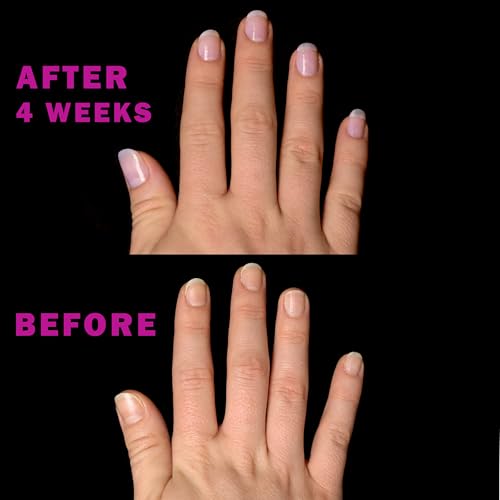 Perfect Formula Pink Gel Coat ? Rosey Glow Nail Strengthener & Keratin Treatment, 0.6 oz - Protein-Rich, Glossy Pink Gel Nail Polish for Damaged Nails | Supports Growth & Repair