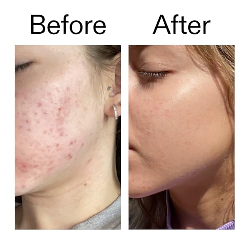 Good Molecules Brightening & Dark Spots Bar Pack 2 ? 85 g / 3 oz Each | Soap Free Face & Body Cleansing Bar with Tranexamic Acid, Kojic Acid & Niacinamide