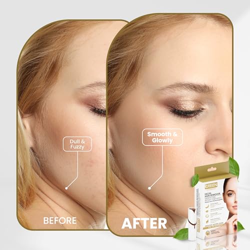 Facial Hair Remover for Women ? Gentle & Painless Removal for Peach Fuzz, Lip & Chin ? USB Rechargeable