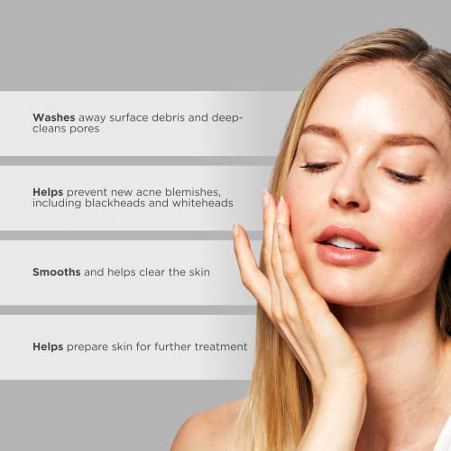 Glytone Acne Clearing Cleanser - Face Wash with 2% Salicylic Acid - Daily Acne Cleanser for Oily Skin & Clogged Pores - Removes Cystic Breakouts, Blackheads, Whiteheads & Blemishes - 6.7 fl oz