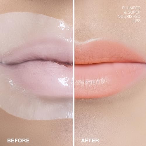 STARSKIN Dreamkiss 2x5g, Hydrating & Plumping Bio-Cellulose Lip Mask, Anti Wrinkle Patches for Lip, Evens Fine Lines & Wrinkles