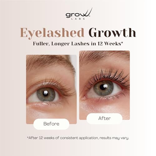 Lash Serum ? Eyelash Enhancer with Peptides & Biotin ? Strengthens, Nourishes & Defines Lashes for Longer, Fuller and Thicker Looking ? Vegan Formula ? Hormone-Free ? Made in USA ? 2 ml