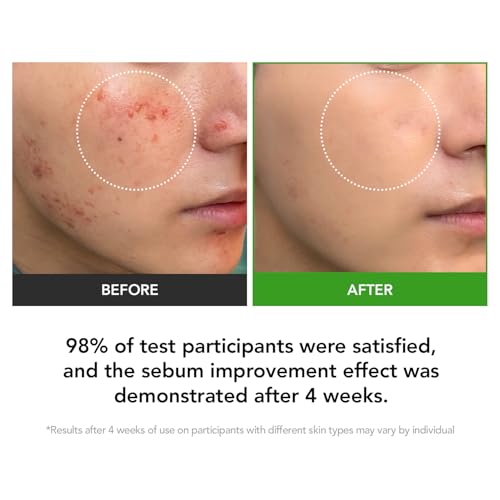 31% Reduction in Sebum & 15.5% High-Dose D-Panthenol | Calms Redness, Repairs Skin Barrier & Locks in Hydration | With Heartleaf Extract | Korean Skincare Daily Moisturizer (35 ml/1.18 fl.oz.)