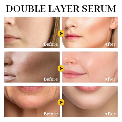 White Truffle First Spray Serum Deep Hydrating Face Mist Light-Weight Facial Mist Korean Skin Care Face Spray Serum for All Skin Types,Smooths & Firming Wrinkles - 3.38 Fl Oz.