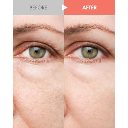 It'S SKIN Collagen Nutrition Toner 150ml 5.07fl. Oz. - Facial For Face Acne Scar Removal Treatment Astringent Hydrating Natural Toner Anti Aging Toners