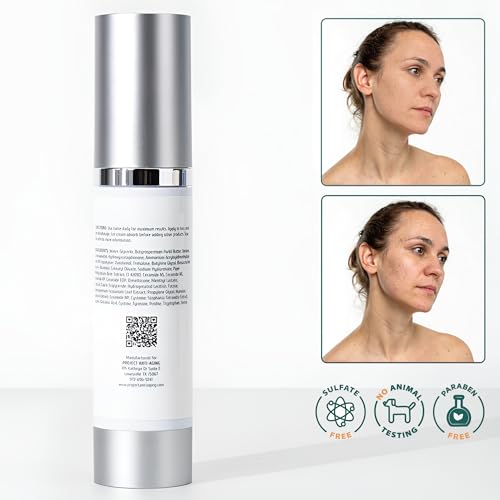 Ceramide Moisturizer for Face ? Barrier Repair Cream for Compromised, Dry, Sensitive Skin ? Deep Hydration & Lipid Support ? Hidratante Facial con Ceramidas