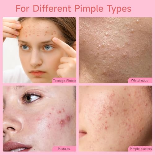 AUSLKA Pimple Patch Bulk, 720 Pimple Patches for Face, Hydrocolloid Spot Patch Stickers for Zits& Blemishes, Suitable for Body, Cheek, Forehead, Chin and Back (8mm, 10mm,12mm)