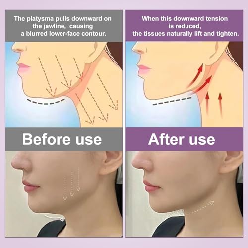 Face Roller Lymphatic Drainage,Face Rollers,Facial Roller,Face Sculpting Tool,Facial Massager? Cooling Metal Face Depuffer, Anti-Puffiness, Prop 65 Tested
