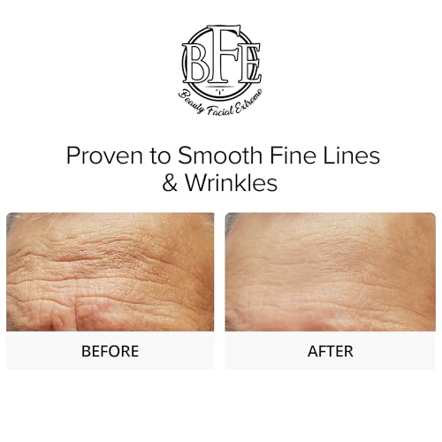 Glycolic Acid 15% Anti-Aging Wrinkle Cream Reduces the Appearance of Fine Lines, Wrinkles, Age Spots, Dark Spots & Improves Dull Looking Complexion. Includes A.H.A & Green Tea Moisturizer.