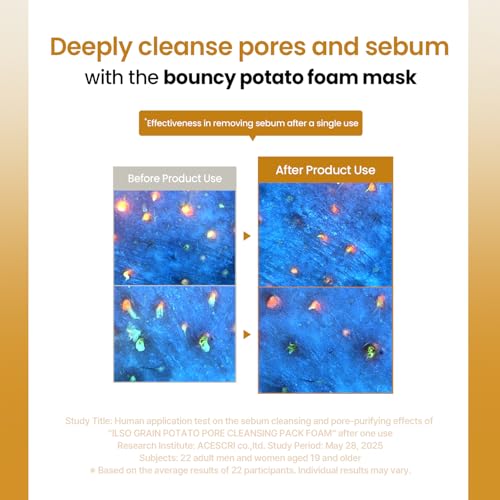 ilso Grain Potato Pore Cleansing Pack Foam, Deep Cleansing Mask for Acne-Prone Skin, with Totarol, Pore Cleanzyme, Daily Exfoliating Cleanser, Korean cleanser, 5.07 fl. oz.
