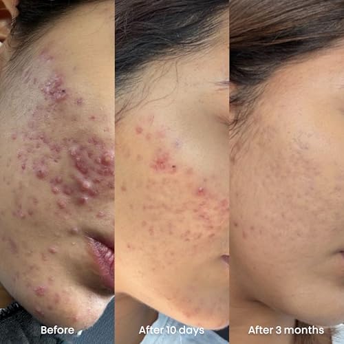 Bioxcin Collagen 5% Anti-Wrinkle Firming Serum 30 ML