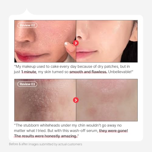 Parnell AHA 9.12% Omija Ceramic Wash-Off Serum | 1-Minute Face Exfoliation for Sebum Control & Smooth Texture | PHA BHA LHA Vitamin C K-Care (1.01 fl oz)