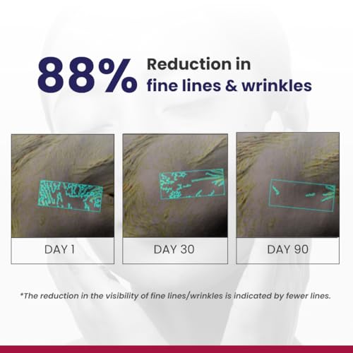 RE' EQUIL 0.1% Retinol Night Cream | Repairs Wrinkles & Fine Lines | Improves Skin Firmness | Beginner Friendly | All Skin Types | 30G