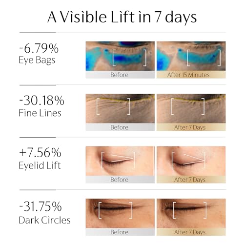 Exo Wand | Anti-Aging Electric Massage Eye Cream for Puffiness Bag Under Eye HME Exosome & PDRN Eye Tightener Cream | Caffeine, Peptide, NAD+ | for Firming, Reducing Wrinkle(0.88 oz/25g)