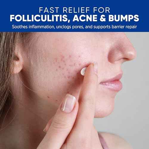 Folliculitis & Acne Treatment Cream ? Salicylic Acid & Herbal Extracts for Scalp, Face, Body & Back ? Soothes Irritated Skin, Redness & Itch Relief ? 100g (Pack of 1)